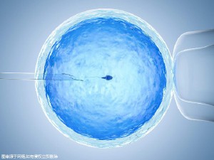 嘉会医疗